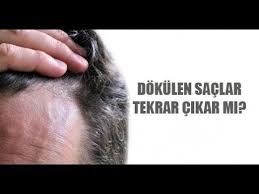 Dokulen Saclari Yeniden Cikaran Beyaz Saclari Eski Rengine Donduren Dogal Kur Youtube Beyaz Sac Sac Yeni Sac
