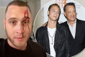 Последние твиты от tom hanks (@tomhanks). Tom Hanks Rapper Son Chet Claims Ex Attacked Him With A Knife In Disturbing Bloody Video Mirror Online