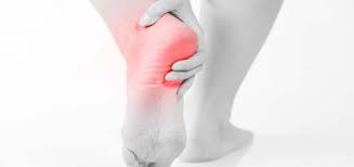 Pin On Plantar Faciitis