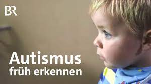 Autismus beim kind, eine entwicklungsstörung im nervensystem wie sich der autismus beim kind äußern kann und welche merkmale sie stutzig machen sollten, verrät ihnen der folgende beitrag. Autismus Diagnose Mit Hirnscans Autismus Fruher Erkennen Gut Zu Wissen Br Youtube