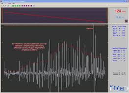 A wide variety of normal blood pressure measurement options are available to you, such as ce. Noninvasive Blood Pressure Monitoring A Review Clinician S Brief