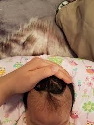 Maybe you would like to learn more about one of these? Receding Hairline Pic February 2017 Babies Forums What To Expect