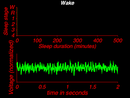 Https Encrypted Tbn0 Gstatic Com Images Q Tbn And9gcsrv7aewlxivzh9vkl4pe77iwvs2jem19iqoa Usqp Cau