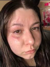 I need a strong survivor to help me. My abuser mentally messed me up that I  had a breakdow. I ended up in a hospital during Covid. I was over  medicated. Im