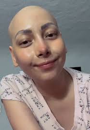 La cirugía de nefrostomía: un paso hacia la salud