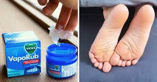 Apply Vicks Vapor Rub To Your Feet To Clear A Cough In An Instant