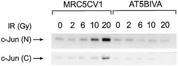 Options trading system spy forex exchange symbols forex. Impaired Ionizing Radiation Induced Activation Of A Nuclear Signal Essential For Phosphorylation Of C Jun By Dually Phosphorylated C Jun Amino Terminal Kinases In Ataxia Telangiectasia Fibroblasts Journal Of Biological Chemistry