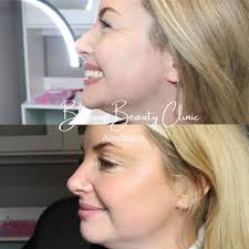 I am excited to share that our Phase 3 clinical trial results