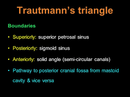 • antrum is well developed at birth. Anatomy Of Ear Mastoid Ppt Video Online Download