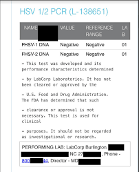 Herpes simplex virus has been recognized in medicine for centuries. Is Overcoming Hsv 1 And 2 Possible Here Is Ms Mal S Story With Herpes Hekma Center