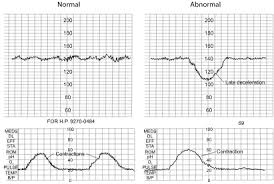 Maternal Care 2 Assessment Of Fetal Growth And Condition