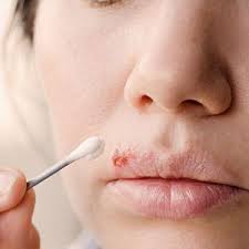 Epingle Sur Astuces Sante