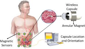 Image result for Wireless Capsule Endoscopy