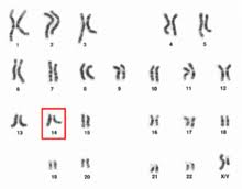 Chromosome 14 Wikipedia