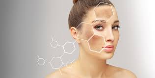 Image result for Diffuse Hyperpigmentation