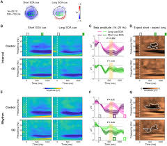 Context Specific Control Over The Neural Dynamics Of Temporal Attention By The Human Cerebellum Science Advances