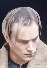 Leon is balding