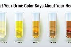 Warna air seni orang sehat. Coba Cek Air Kencing Anda Apakah Berbusa Jika Ya Bisa Jadi Tanda Awal 4 Penyakit Ini Semua Halaman Intisari