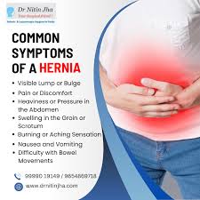 Image result for stomach hernia symptoms