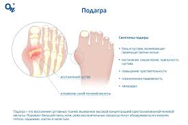 Подагра: симптомы, лечение и диета