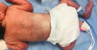 Image result for Harlequin Color Change