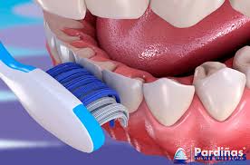 Cepillado De Dientes Como Lavarse Los Dientes Correctamente Clinica Pardinas