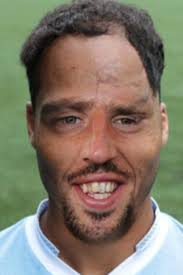 We did not find results for: Oddsbible On Twitter If Franck Ribery And Joleon Lescott Morphed Into One Http T Co 33wyokjb