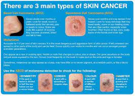 Learn more about the different types of skin cancer, so you can spot potential problems early. Pin On Cancer Statistics And Facts