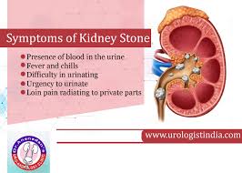 Bladder Stone Surgery Chennai Kidney Stones