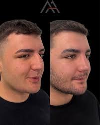 My pretty angel @meliscelikler