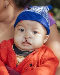 Love Without Boundaries ❤️ Every Child Counts