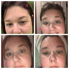 My beauty since 05/2021. No problems yet :-)