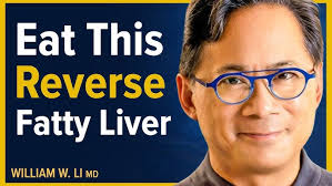 Non-Alcoholic Fatty Liver Disease