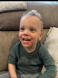 Ok so over the last two days, my 10 year old son with spastic quad CP has  started sweating from his head. Now I don't mean a little bit of sweat. I