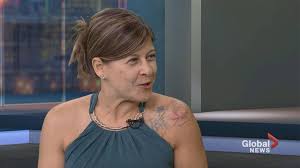 Breast augmentation is one of the most popular plastic surgery procedures in the world. Montrealer Says Breast Implants Banned In Europe Still Being Used In Canada Montreal Globalnews Ca