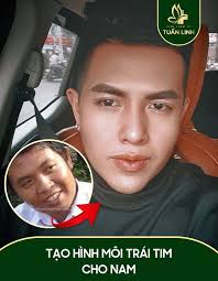 7 QA cắt môi trái tim cho NAM