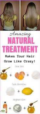 The Next Natural Home Remedy Will Help You Grow Your Hair In A Very Short Amount Of Time Grow Hair Hair Health Healthy Hair