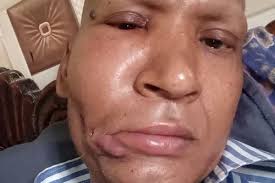 Fundraiser by Yasir Malik : Nafees Alam has mouth cancer