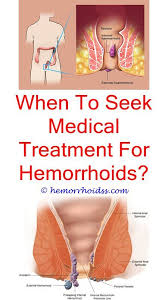 The nonstick and smooth formula of that is highly recommended to patients. 760 Skin Ideas Bleeding Hemorrhoids Hemorrhoids Treatment Getting Rid Of Hemorrhoids
