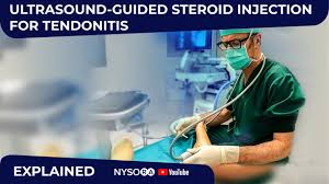 Image result for Tendon Sheath Injection