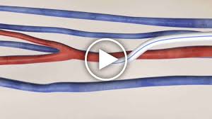 نتیجه جستجوی لغت [graft] در گوگل