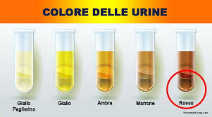 Fate esercizio fisico e bevete molti liquidi per alcuni giorni/settimane prima del test, e dovreste farcela. Urina Trasparente Un Importante Indicatore Per La Prostata