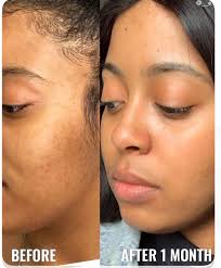 Kojic Acid Turmeric Soap: Lemon & Honey, Handcrafted