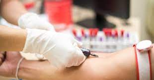 Ø§Ø·Ù…Ù† Ø¹Ù„Ù‰ Ù†ÙØ³Ùƒ Ù…Ø§ Ù‡Ùˆ ØªØ­Ù„ÙŠÙ„ Ø¹Ø§Ù…Ù„ Rh ÙˆØ£Ù‡Ù…ÙŠØªÙ‡ Ø§Ù„ÙŠÙˆÙ… Ø§Ù„Ø³Ø§Ø¨Ø¹