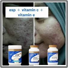 Jadi tak perlu risau untuk gunakan pada kulit bayi. Testimoni Set Kulit Shaklee Hanna Vita S Shoppe