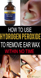 However, he says a trip to your doctor is best so that they can: How To Use Hydrogen Peroxide To Remove Ear Wax Remedies Lore
