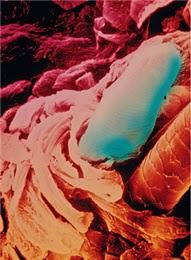 Uses, indications, side effects, dosage. Rosacea Die Rote Gefahr Pz Pharmazeutische Zeitung
