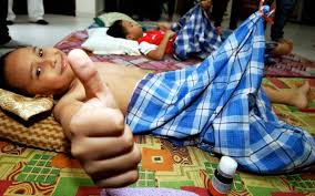 Hal ini disebabkan adanya pengendapan purin tinggi yang berkelanjutan dalam sendi. Berkhatan 10 Tips Jaga Anak Masuk Jawi Free Malaysia Today Fmt