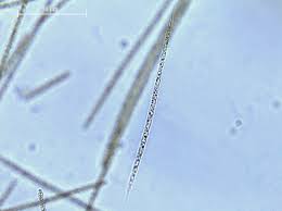 Image result for Raphidiocystis