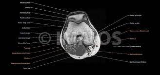In this presentation mri anatomy has been discussed. The Knee Mri Atlas Of Anatomy In Medical Imagery